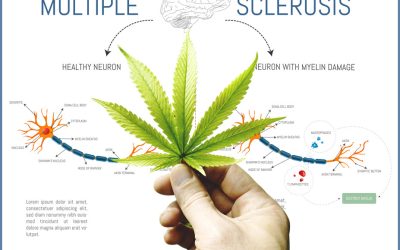 Cannabis For Multiple Sclerosis: What The Latest Studies Say